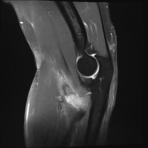 Click on the Serie image to view the images of Wieszt, Gnter